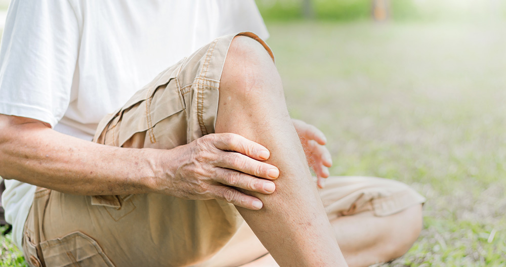 Tips For Managing Varicose Veins in Summer | Veincentre