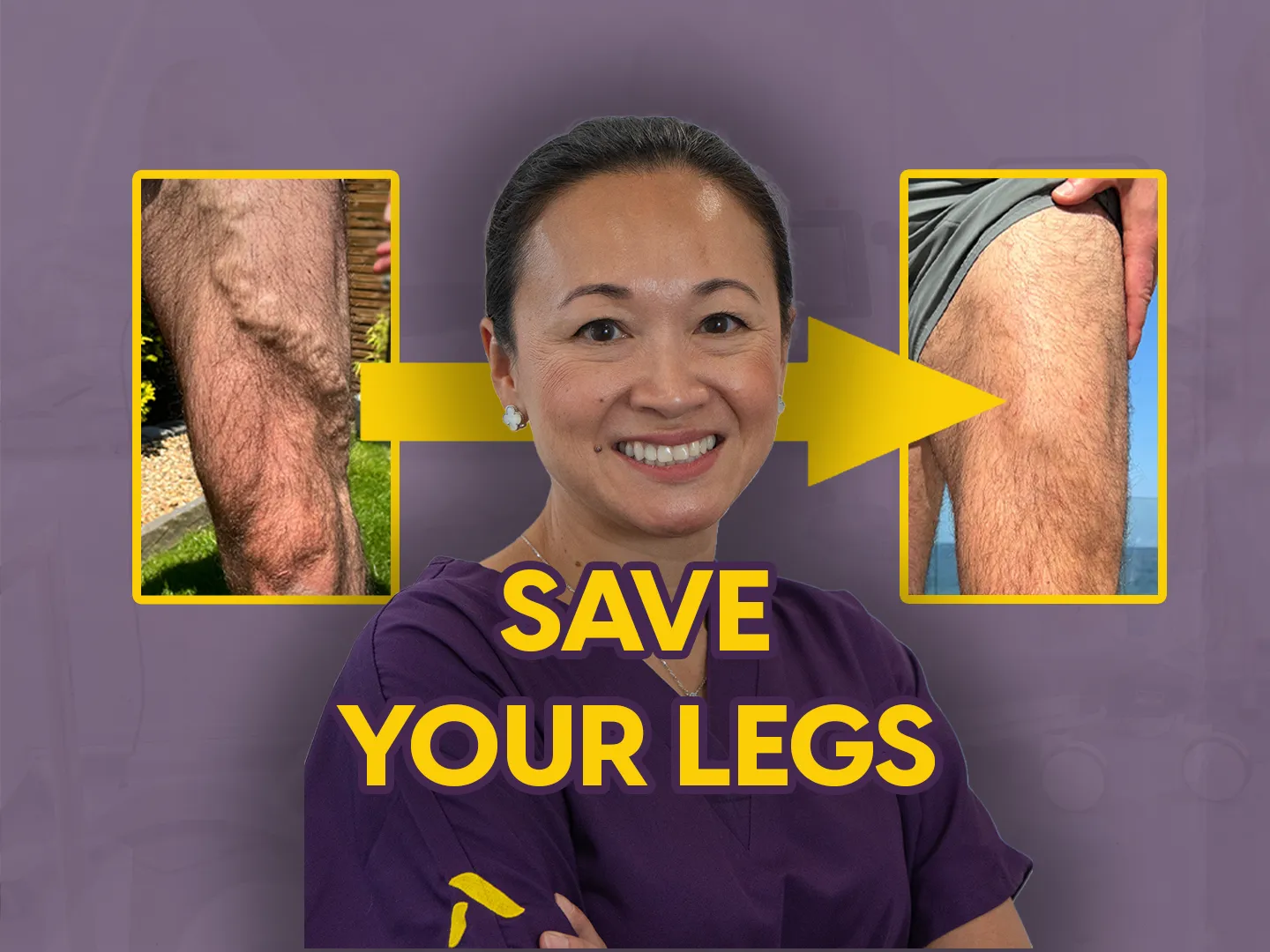 Varicose Veins: More Than Just a Cosmetic Concern