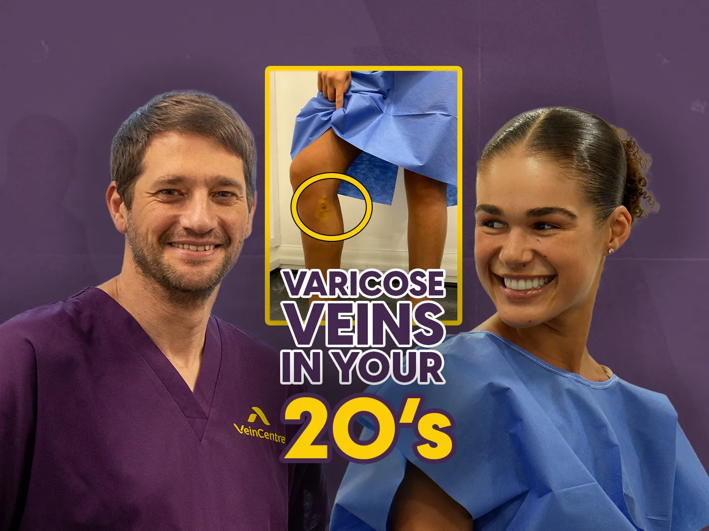 Can Young People Get Varicose Veins?