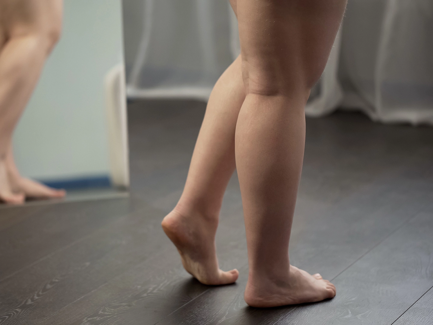 Do Spider Veins Go Away?